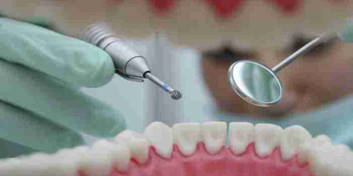 Dental Consumables Market To Witness Huge Growth By 2032