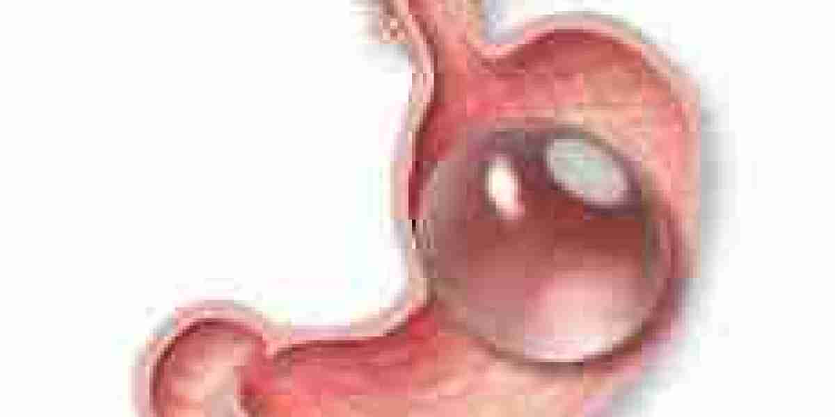 Intragastric Balloon Market Rewriting Long Term Growth Story