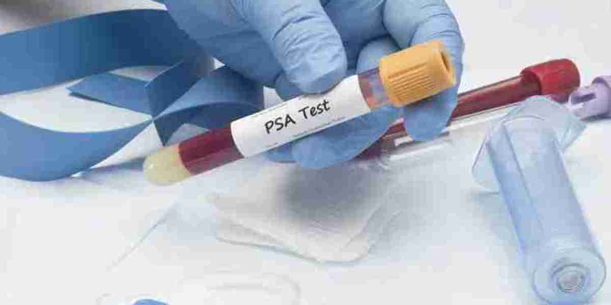 Prostate Cancer Diagnostics Market Manufacturers, Competitive Analysis And Development Forecast to 2024 – 2032