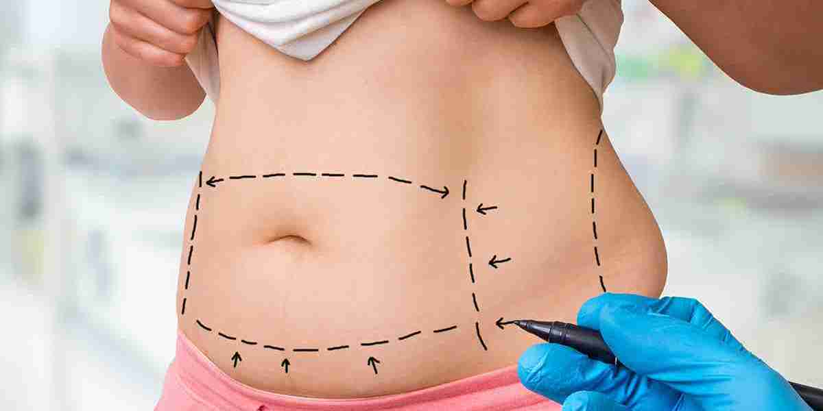 Non-Invasive Alternatives to Liposuction: Exploring Options in Dubai