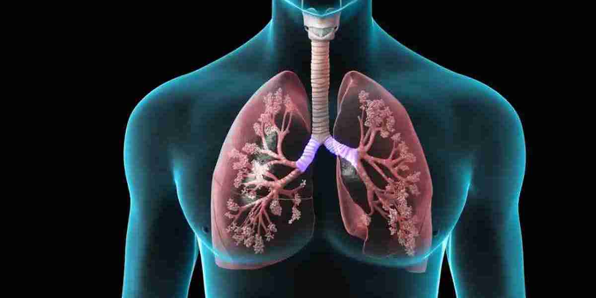COPD Devices Market Size, Sales Revenue, Comprehensive Research Study Focus on Opportunities