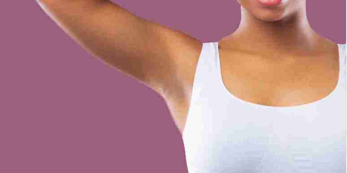 Hyperhidrosis Treatment in the UK with RejuvaMed Skin Clinic