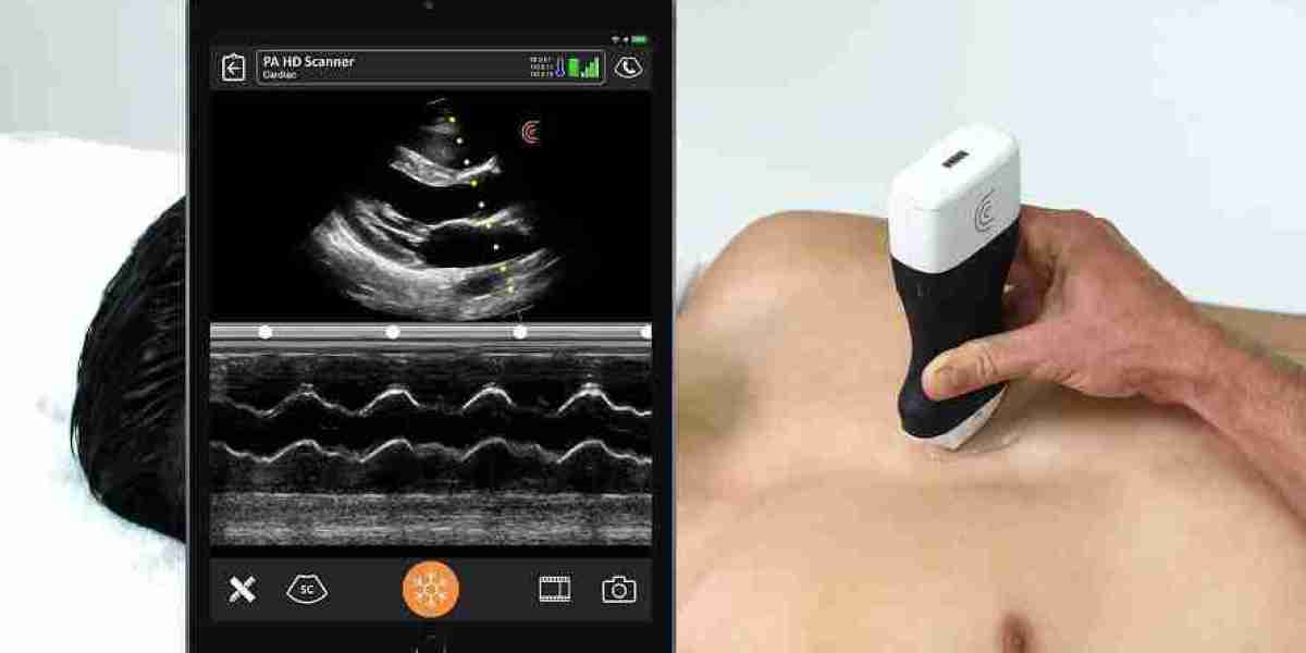 Handheld Echocardiography Devices Market Unidentified Segments – The Biggest Opportunity Of 2024