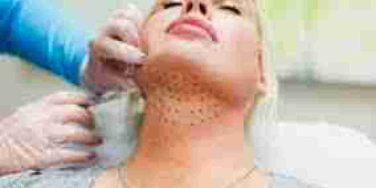 Defining Beauty: Kybella Double Chin Treatment in Dubai
