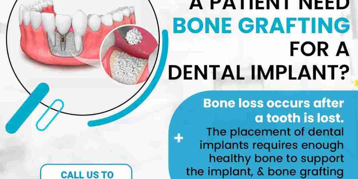 Find Best Dental Crowns Treatment in Noida