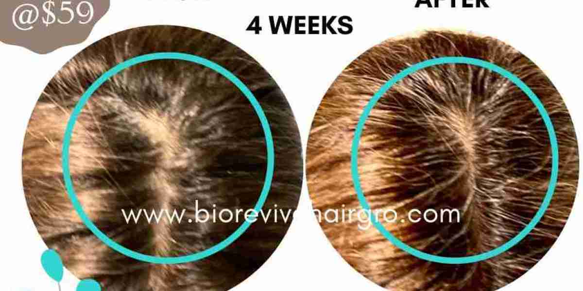 Experience Ultimate Hair Growth with BioReviveHairGro