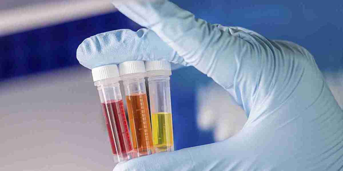In-vitro Diagnostics Market is Set To Fly High in Years to Come