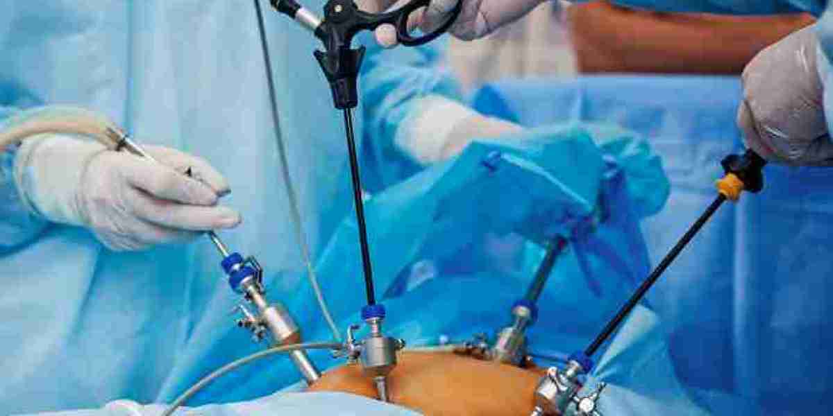 Bariatric Surgery Devices Market Share, Trend, Segmentation and Forecast 2030
