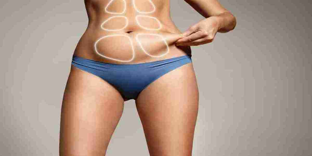 Experience the Future of Liposuction BodyTite in Riyadh