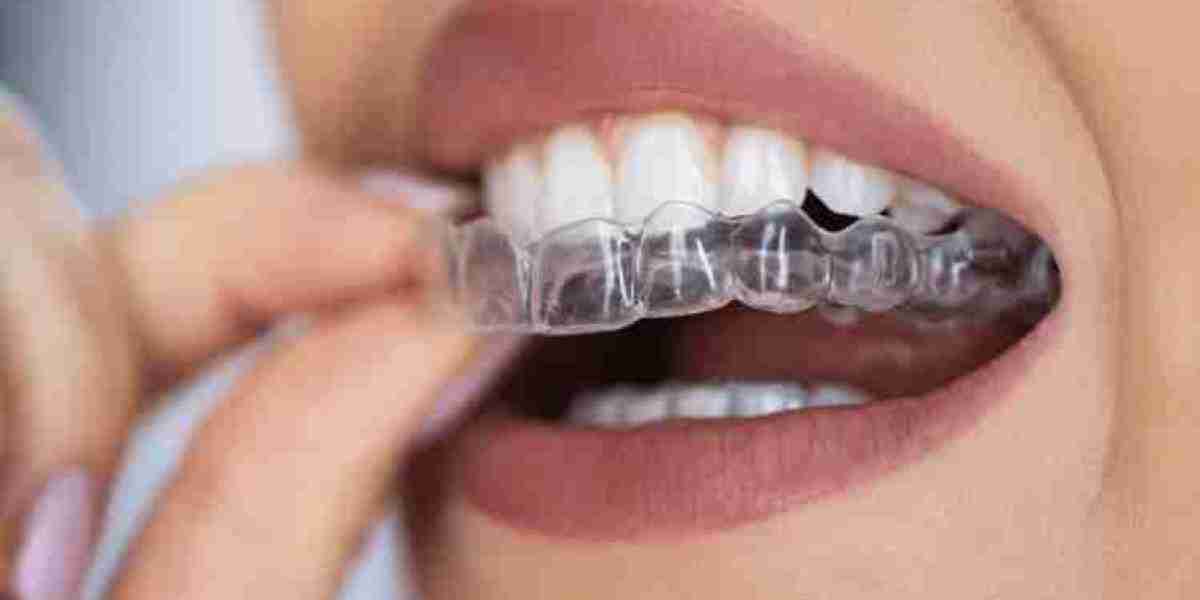 Clear Aligners Market is set for a Potential Growth Worldwide: Excellent Technology Trends with Business Analysis