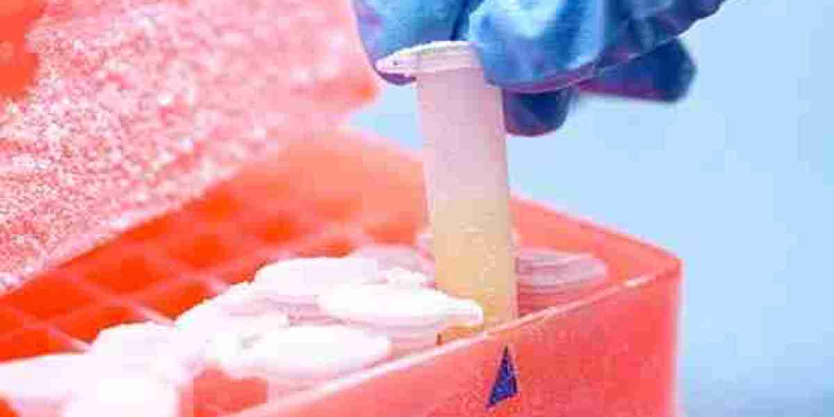 Cell Cryopreservation Market 2023 Size, Growth Factors & Forecast Report to 2032