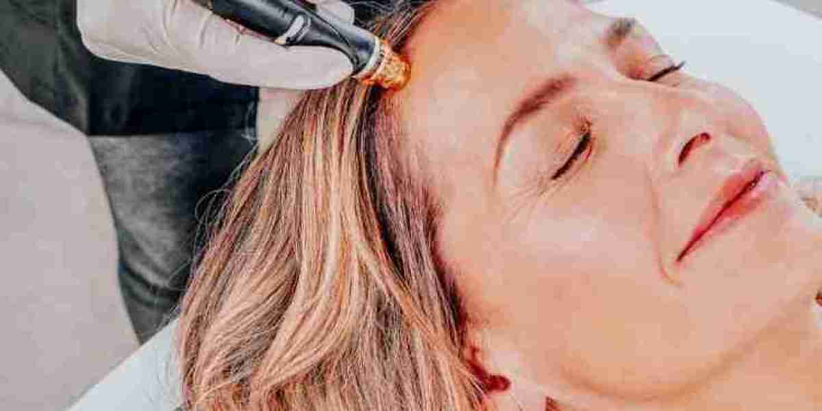 10 Reasons to Try Hydrafacial Scalp Treatment in Dubai