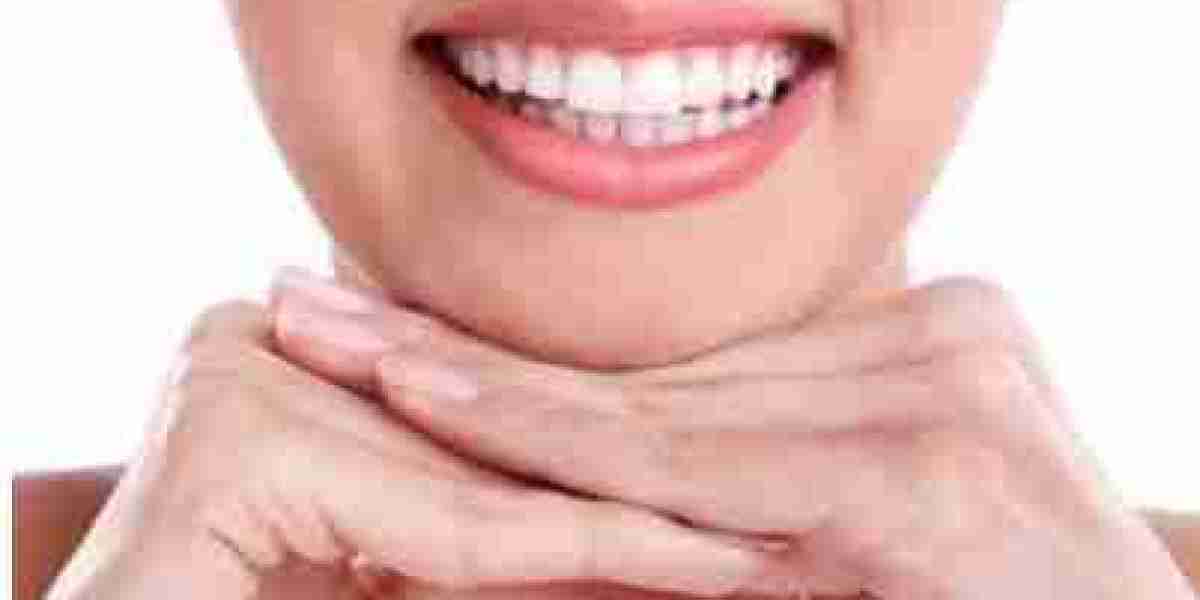 Enhancing Your Smile: Choosing Between Dental Implants and Dentures