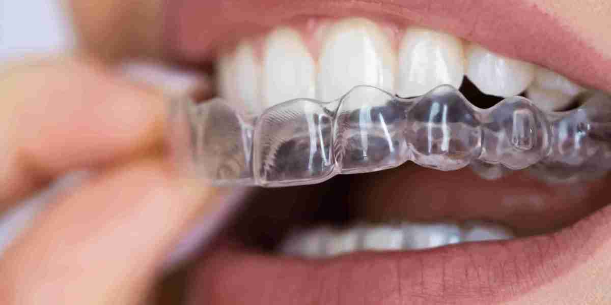 FAQs About Clear Aligners: Dubai's Most Common Queries Answered