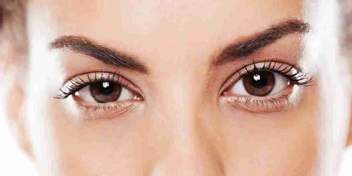 Renew Your Look: Eyelid Xanthelasma Removal in Dubai