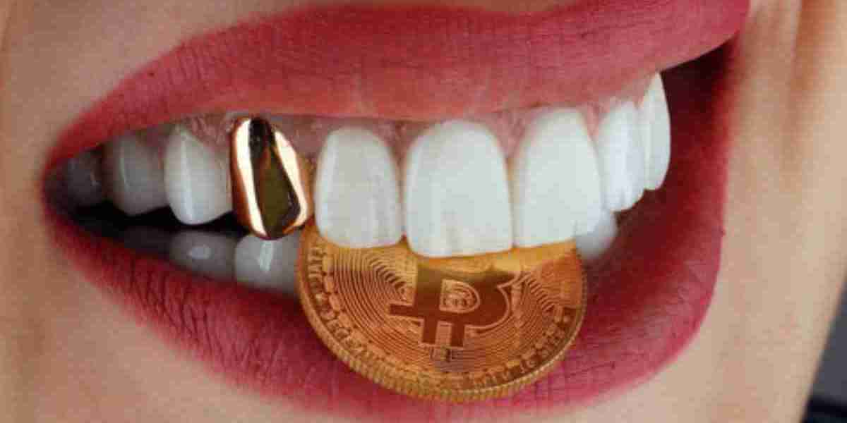 Gold Teeth in Dubai: A Luxury Symbol