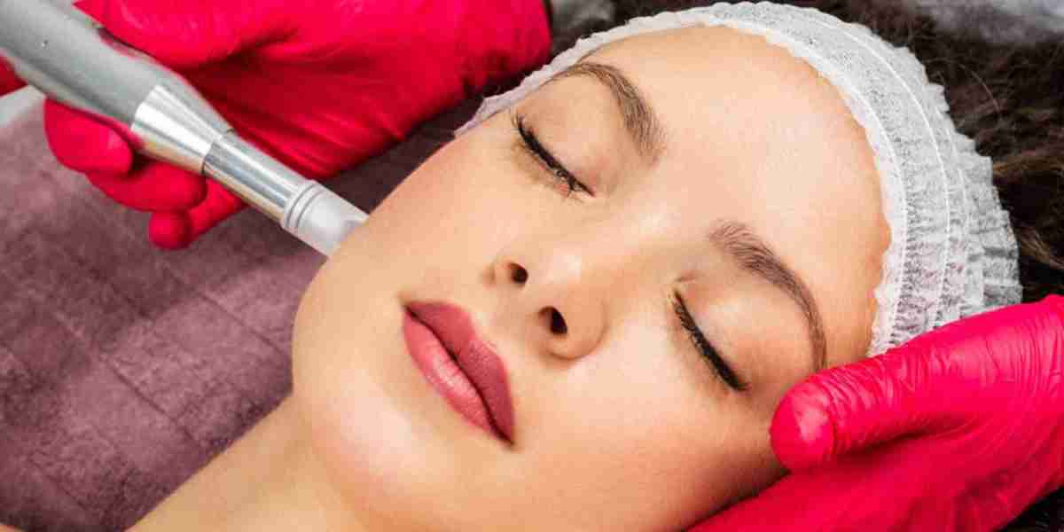 Microneedling Unveiled: Pros, Cons, and Promising Health Outcomes