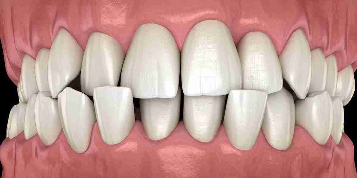 Malocclusion Market Segment and Industry Growth Forecast by 2031