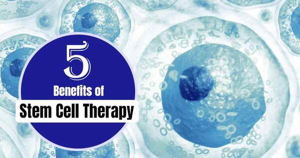 5 Benefits of Stem Cell Therapy | Your Best Stem Cell Banking Guide