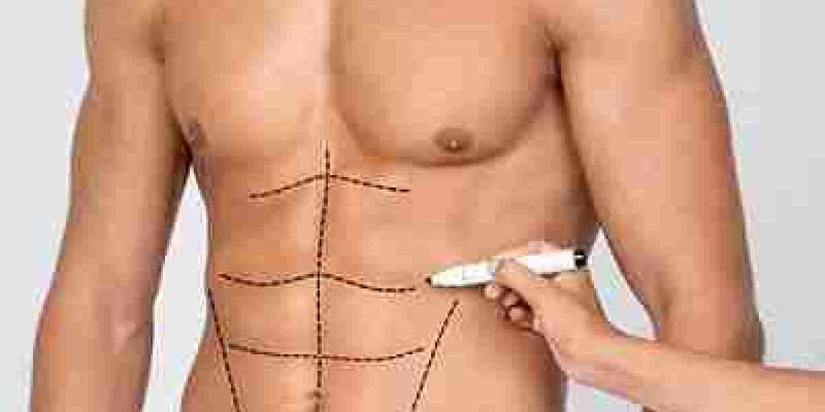 The Future of Cosmetic Surgery: Liposuction Trends in Dubai