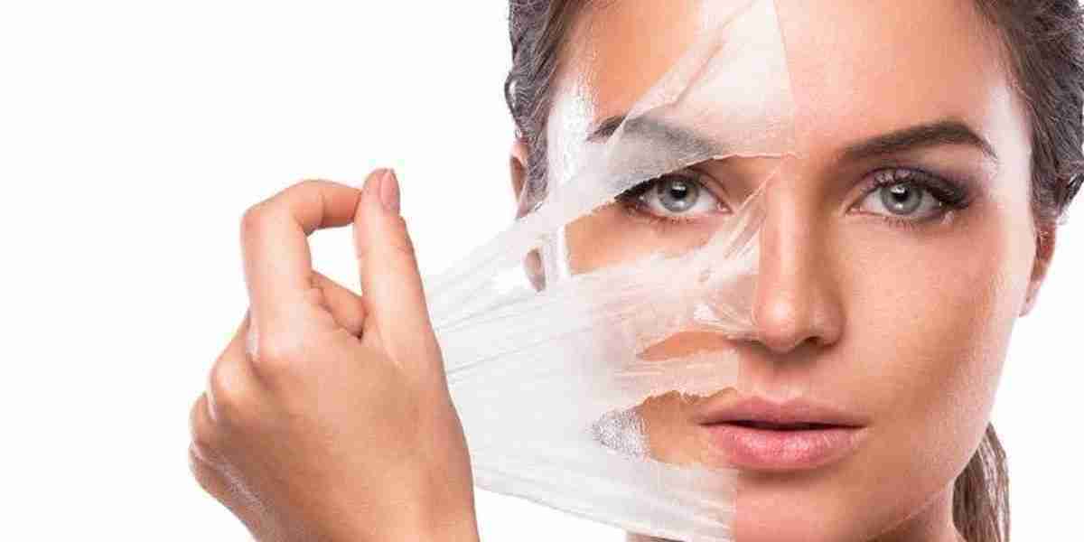 Achieving Youthful Radiance: Chemical Peels in Dubai's Cosmetics Industry