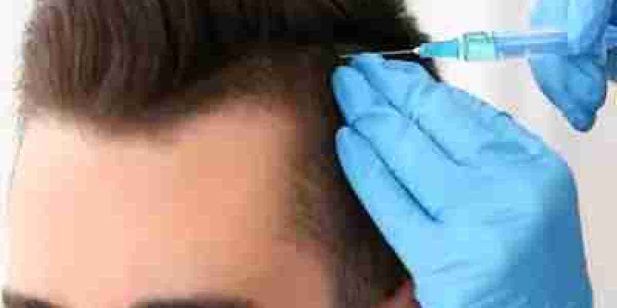 Dubai's Best-Kept Secret: Transformative Hair Loss Treatments Revealed
