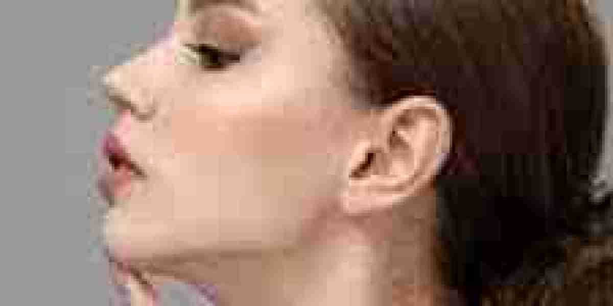 Jawline Contouring: A Symbol of Sophistication in Dubai's Beauty Scene