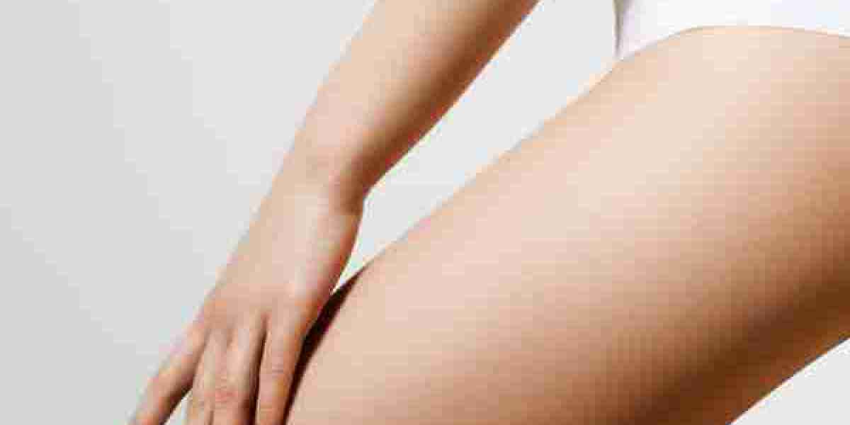 3 Important Factors to Consider Before Getting a Thigh Lift