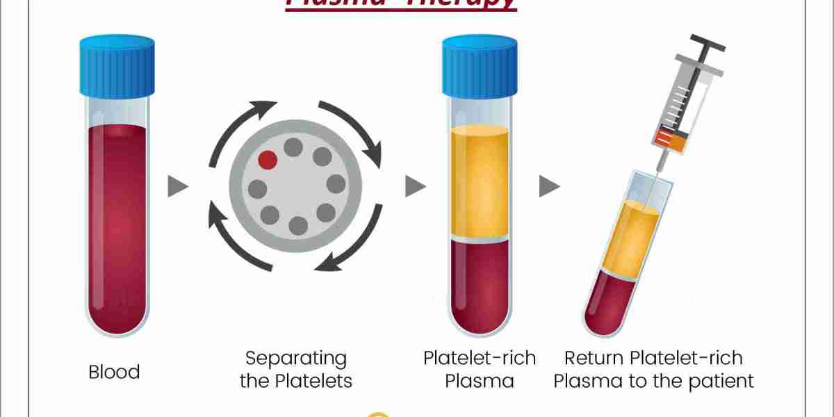 Anticipated: Plasma Therapy Market to Hit $882.5 Million by 2028