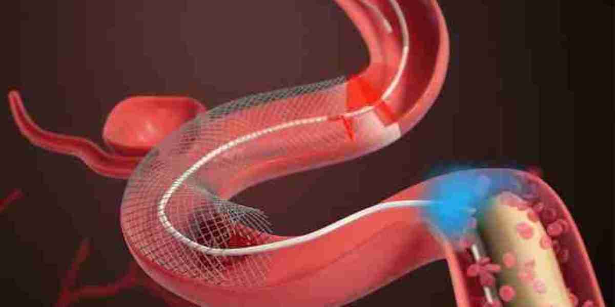 Neurovascular Catheters Market omprehensive Study Explore Huge Growth in Future
