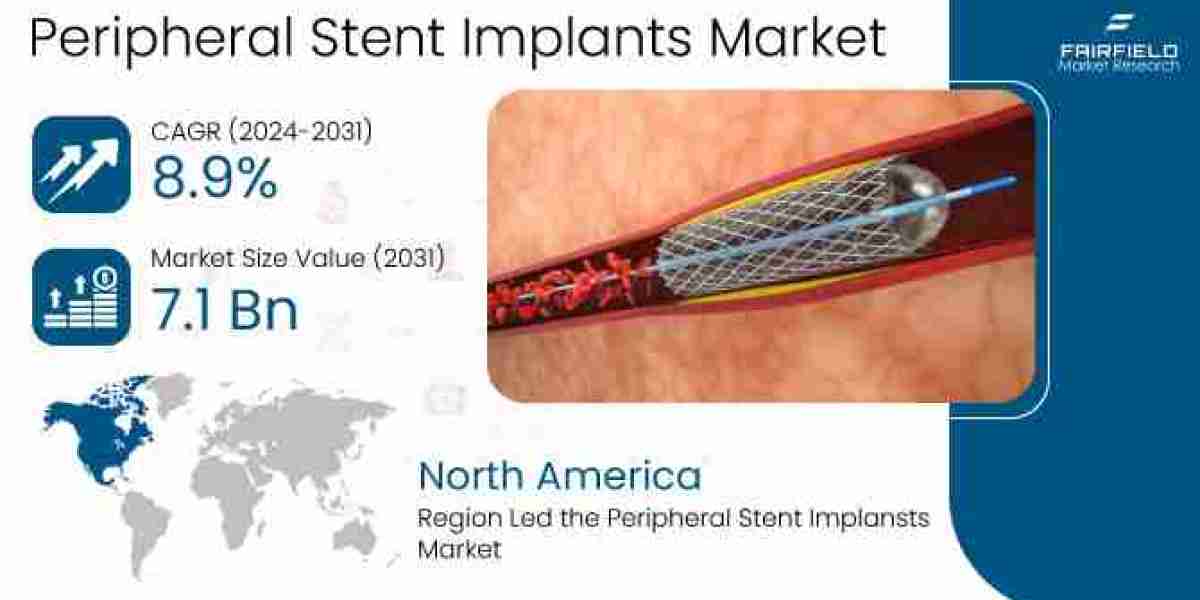 Peripheral Stent Implants Market Growth, Trends, Size, Share, Demand ,Business Strategies uture Prospects And Top Growin