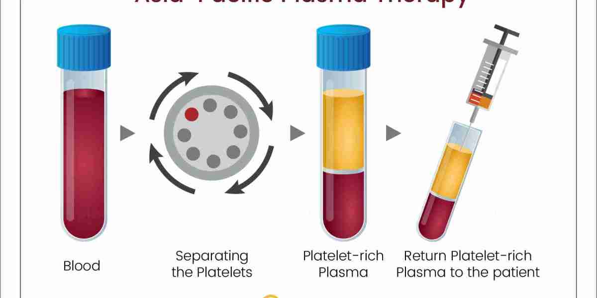 Asia-Pacific Plasma Therapy Market Expected to Reach $214 Million by 2030