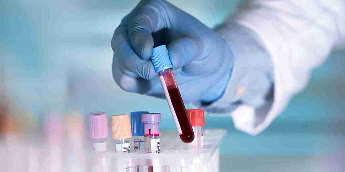 Global Liquid Biopsy Market Application, Trends, Growth, Opportunities and Worldwide Forecast 2016 – 2030
