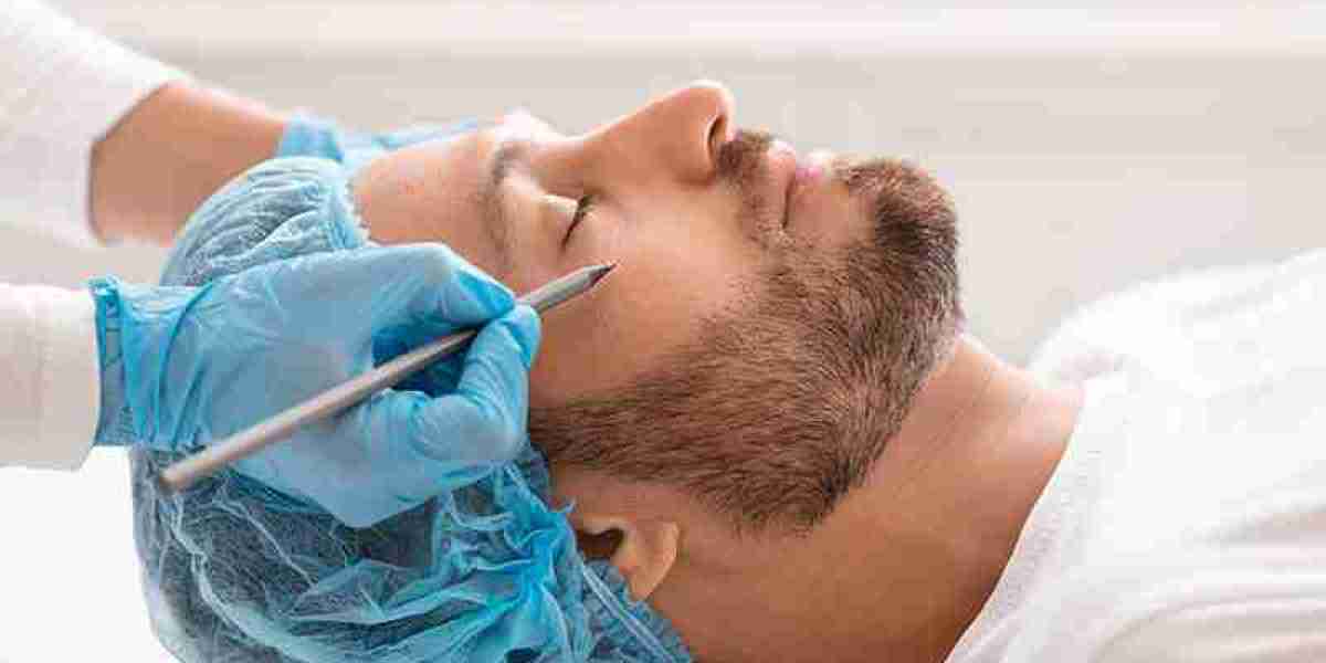 Nose Surgery for Male: Costs, Recovery, and Results Revealed