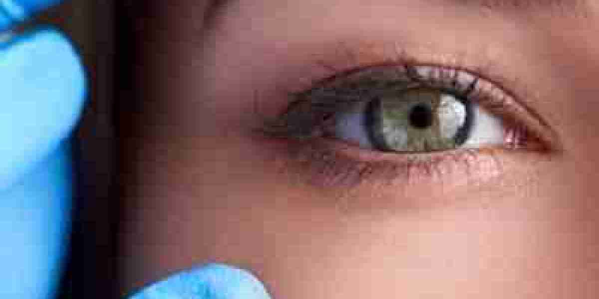 The Ultimate Guide to Eyelid Surgery in Dubai: 5 Things to Know