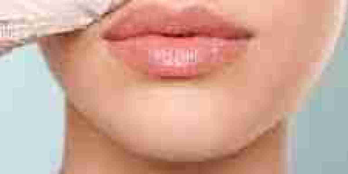Luxe Lips: Lip Augmentation Experiences in Dubai's Top Clinics