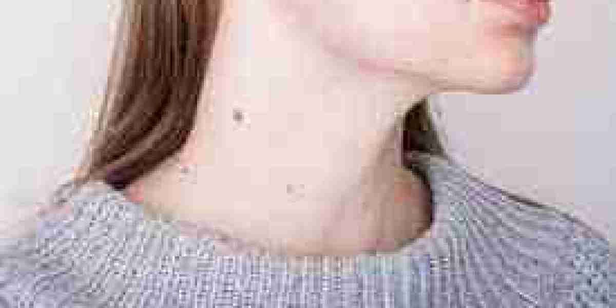 Unlocking Confidence: Skin Tag Removal Solutions in Dubai