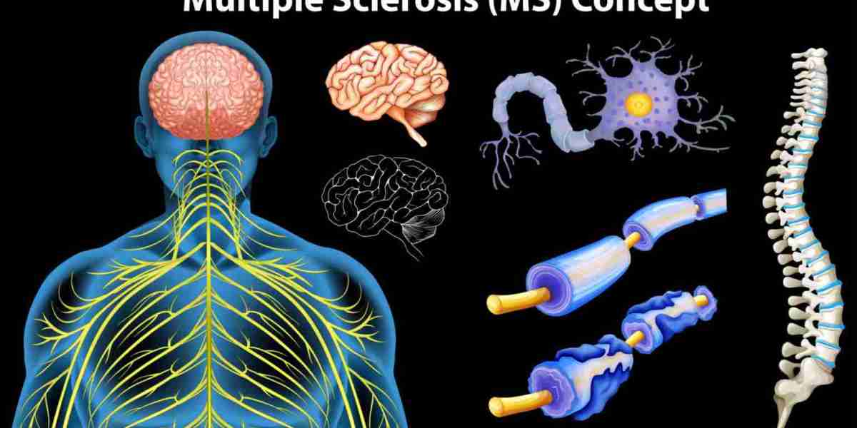 Understanding Multiple Sclerosis: Symptoms, Causes, and Treatments