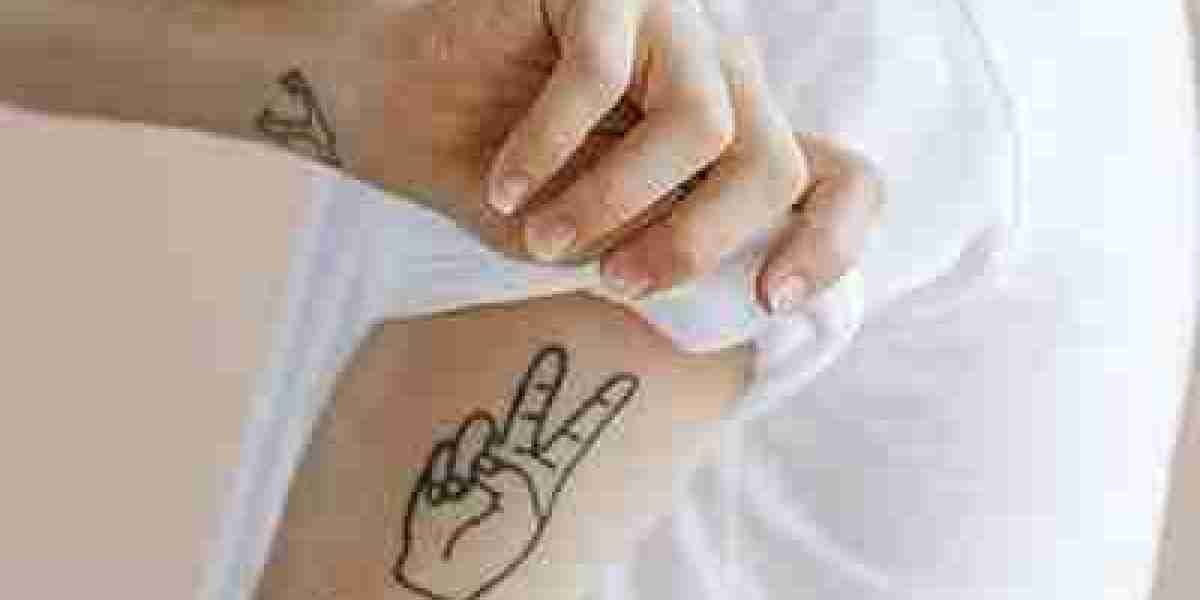 The Top 10 Benefits of PicoSure Tattoo Removal in Dubai