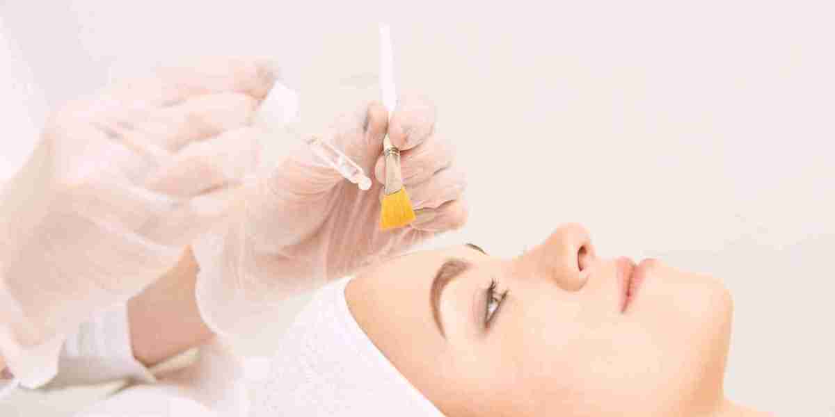 Say Goodbye to Imperfections: Chemical Peeling Treatments in Dubai