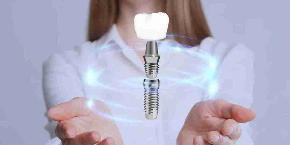 Reclaim Your Confidence: Explore Dental Implants Specialist Services