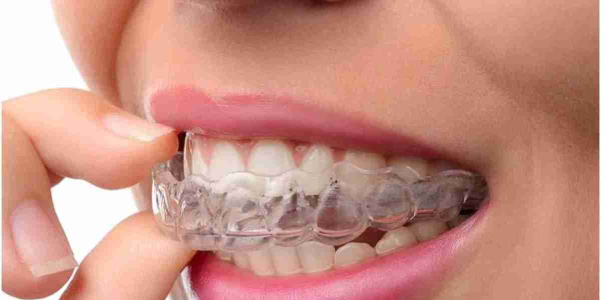 Unlocking Dubai's Secret to Straight Teeth: Clear Aligners