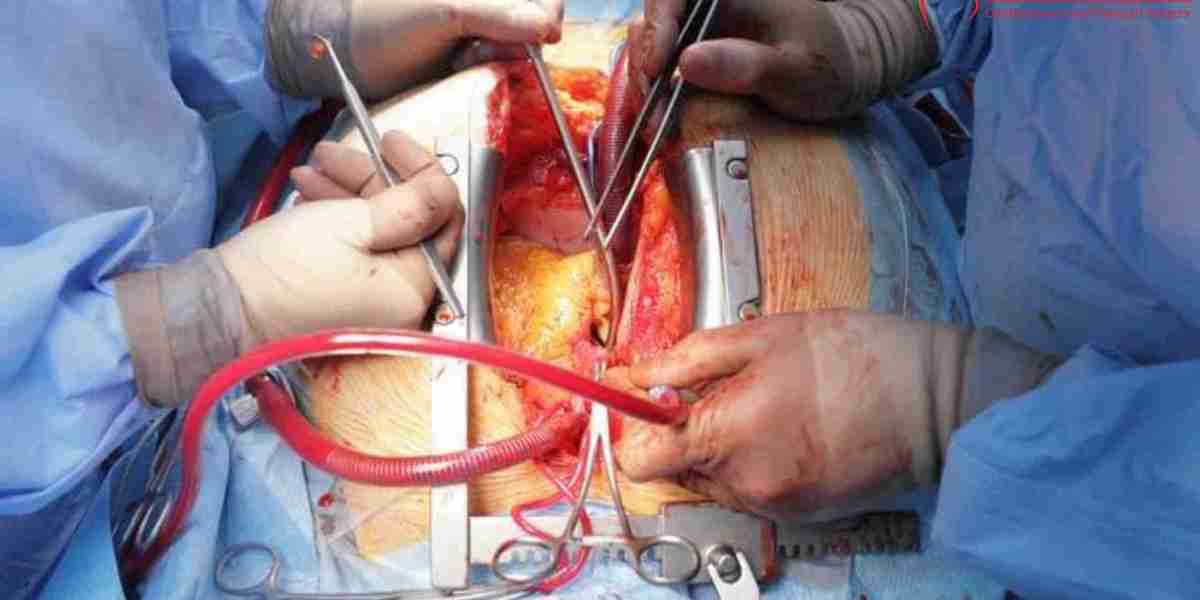 Dr. Brijmohan Singh - Best Cardiothoracic & Vascular Surgeon In Bhavnagar