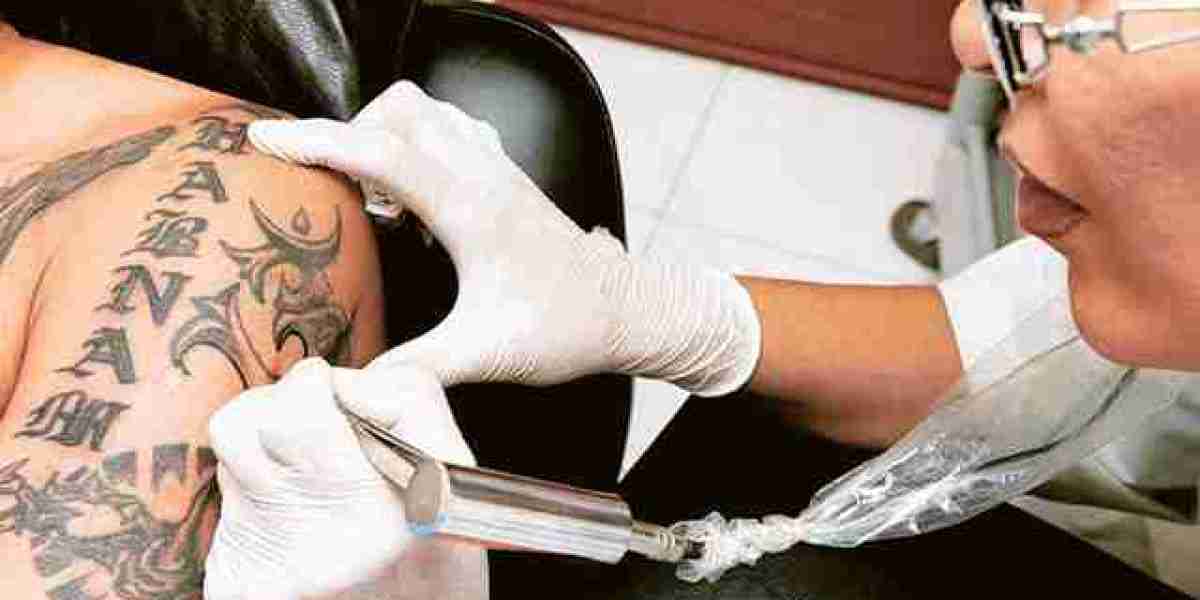 Erased Expectations: Unveiling the Best Tattoo Removal in Dubai?