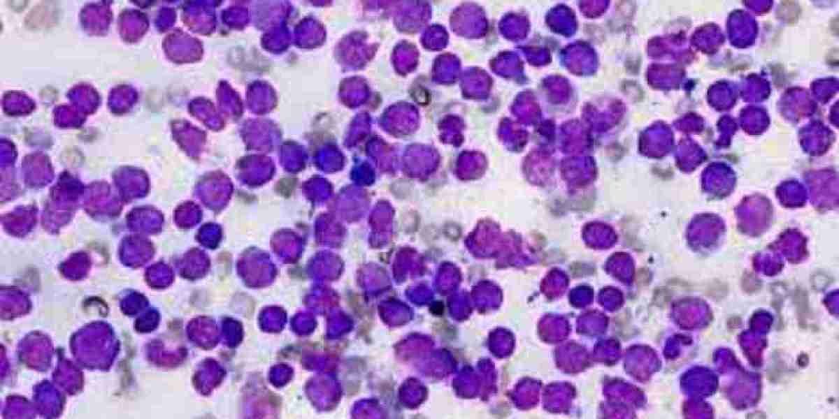 Acute Lymphoblastic Leukemia Market Report 2024: Epidemiology, Industry Trends, Size, Share and Forecast to 2034