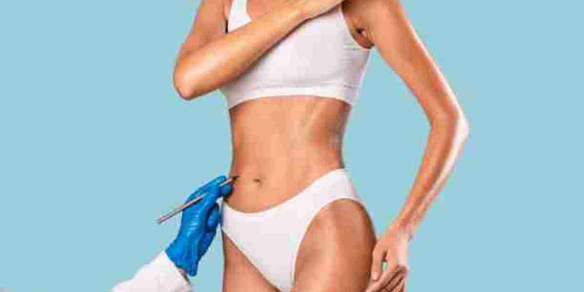 Liposuction for Weight Loss: Debunking Myths in the Dubai Context