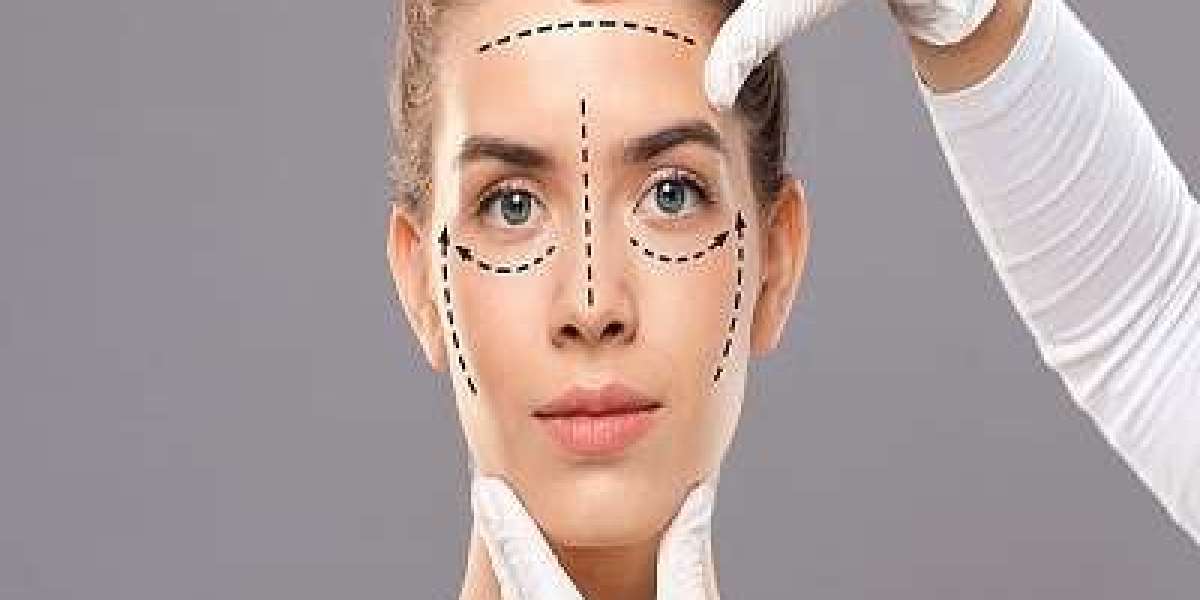 Understanding the Facelift Procedure: A Comprehensive Guide