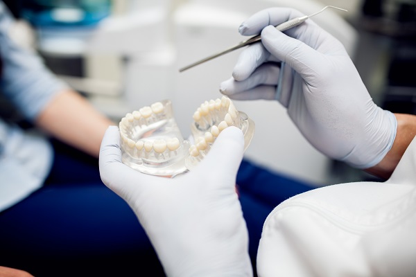 Quality Dental Crowns in Houston | Tooth Cap - All Stars Dental