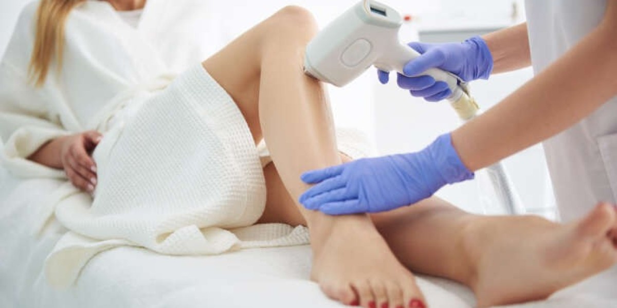 Radiant Skin Redefined: Laser Hair Removal Excellence